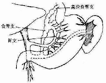 冠状静脉局部解剖示意图