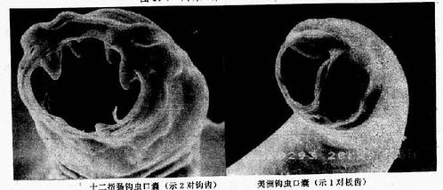 两种钩虫口囊扫描电镜图